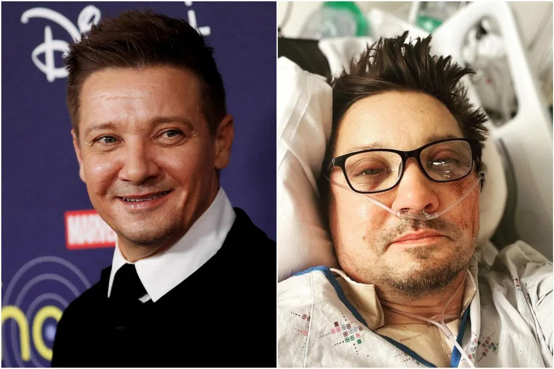 Jeremy Renner was left with “30 plus broken bones” after the accident.
