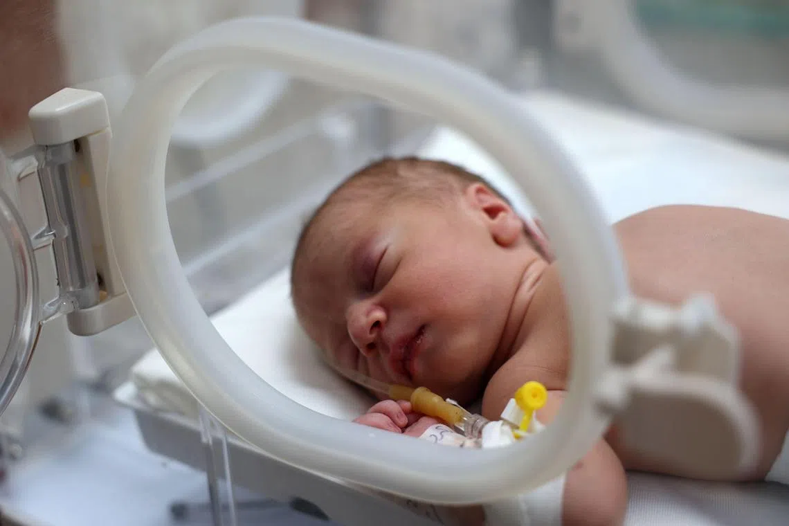 Baby Malek, who was reportedly delivered by Cesarean section after his 9-months pregnant mother succumbed to her injuries sustained during an overnight Israeli strike on Nusseirat in the central Gaza Strip, lies in an incubator at the al-Awda hospital in Deir el-Balah on July 20, 2024. The mother barely survived a night of missile strikes that rescue services across the Hamas-run territory said killed more than 24 people, including six members of the same family. Doctors were unable to save the mother, but performed an ultrasound that detected the baby's heartbeat. They then quickly staged an emergency cesarean section "and extracted the fetus," the surgeon told AFP. (Photo by Eyad BABA / AFP)