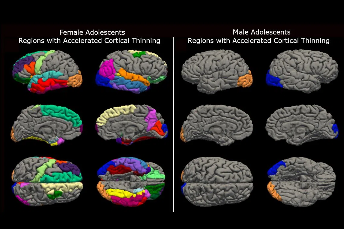Areas of the brains of subjects in a study of adolescent brain development. The thinning of the cortex is seen by scientists as the brain rewiring itself as it matures. 