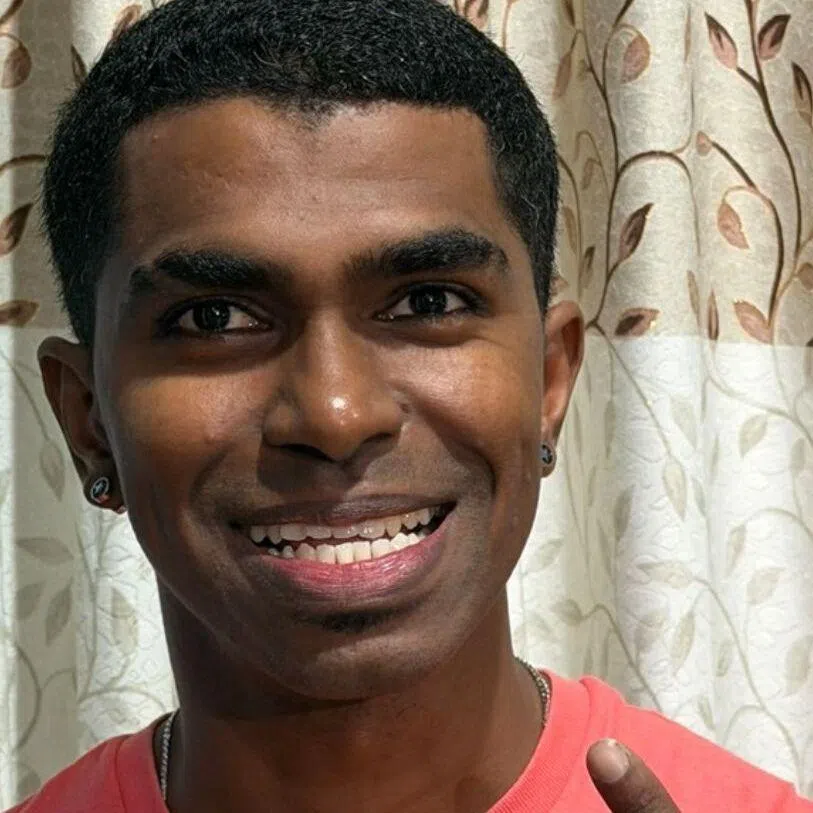 Engineer Prathab Muniandy said he first noticed that he had more teeth than average during a family gathering 2021.