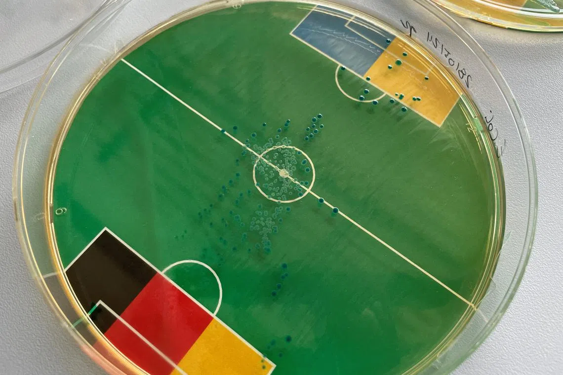FILE PHOTO: A petri dish, \"bacteria oracle\", predicting the outcome of the soccer-friendly match between Germany and Ukraine is pictured at the microbiology laboratory of Professor Markus Egert in Villingen-Schwenningen, Germany, May 31, 2024. According to the amount of Escherichia coli bacteria in the Ukrainian box, Germany will beat Ukraine. REUTERS/Christine Uyanik/File Photo