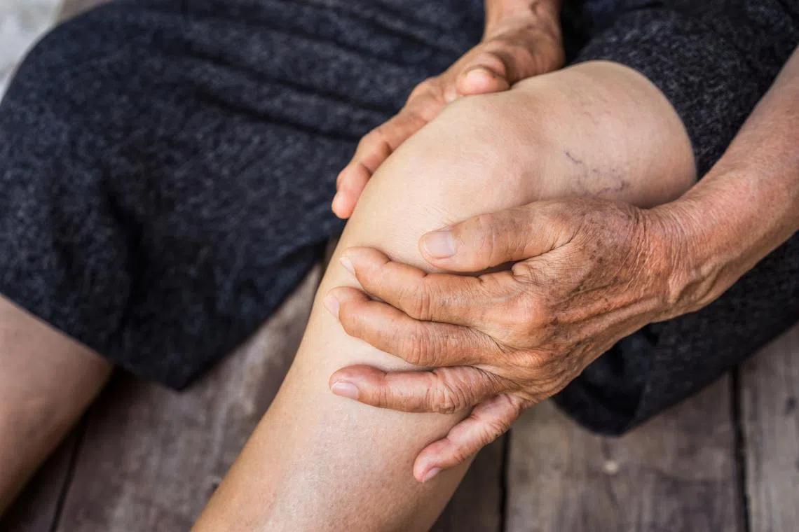 Arthritis is a catch-all term for the more than 100 kinds of inflammatory joint conditions.