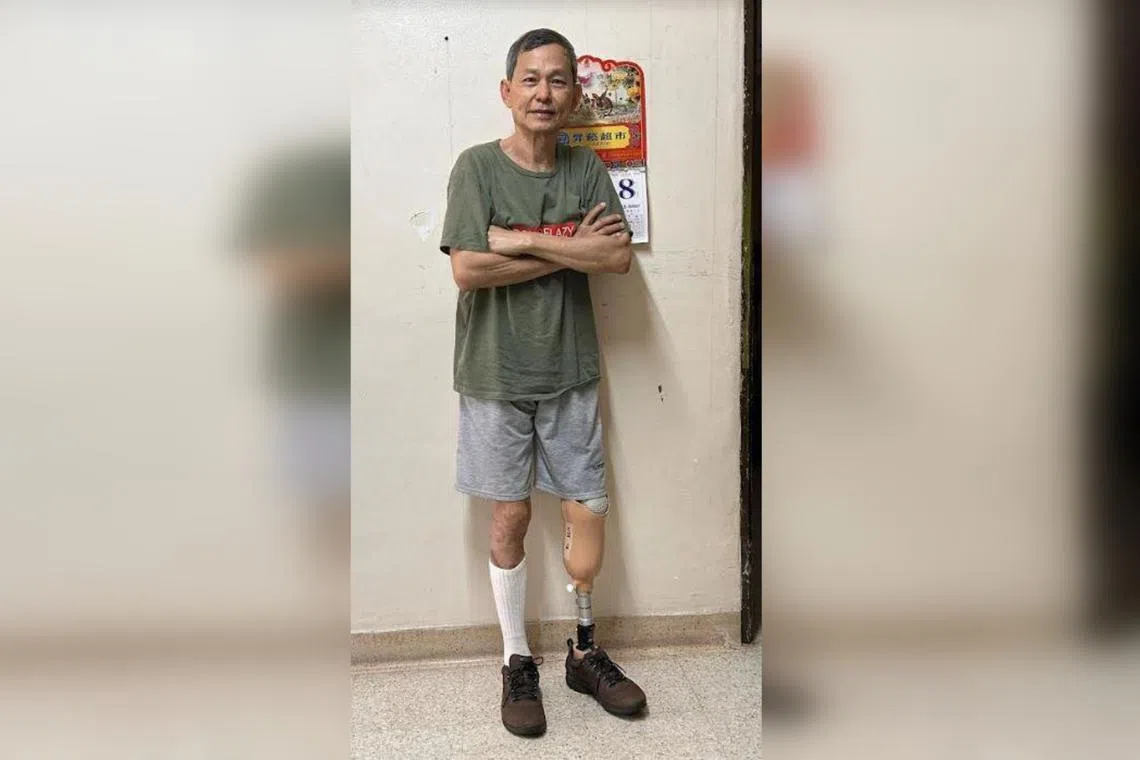 Duan Weiming was fitted with a prosthetic leg recently. 