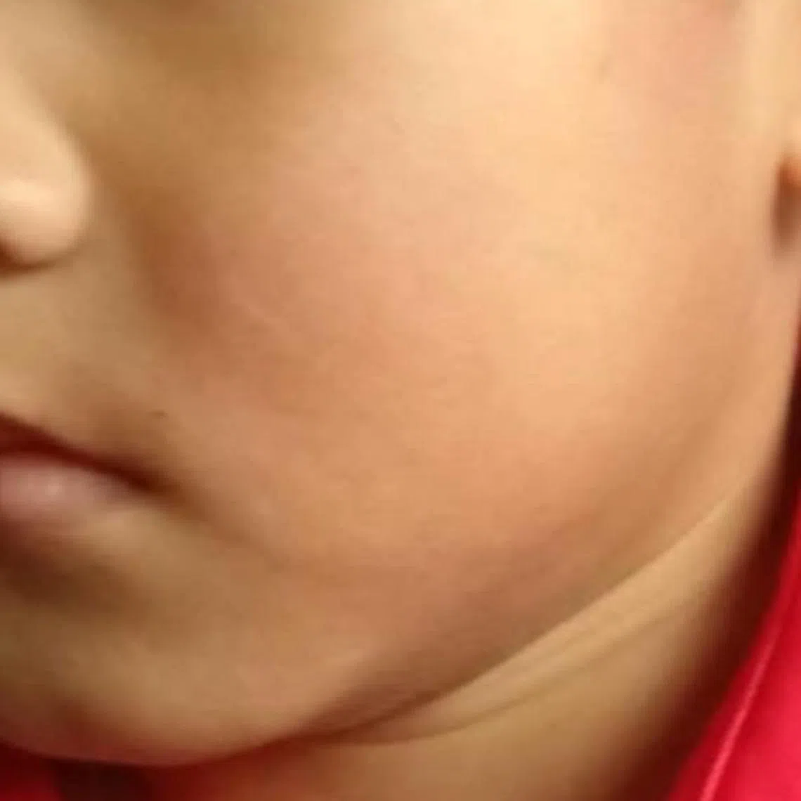 The boy was allegedly slapped after showing his middle finger during a game of catching. 