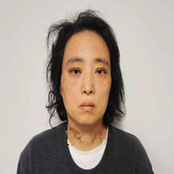 Myeong Jae-wan is accused of stabbing a pupil at an elementary school in Daejon in February 2025.
