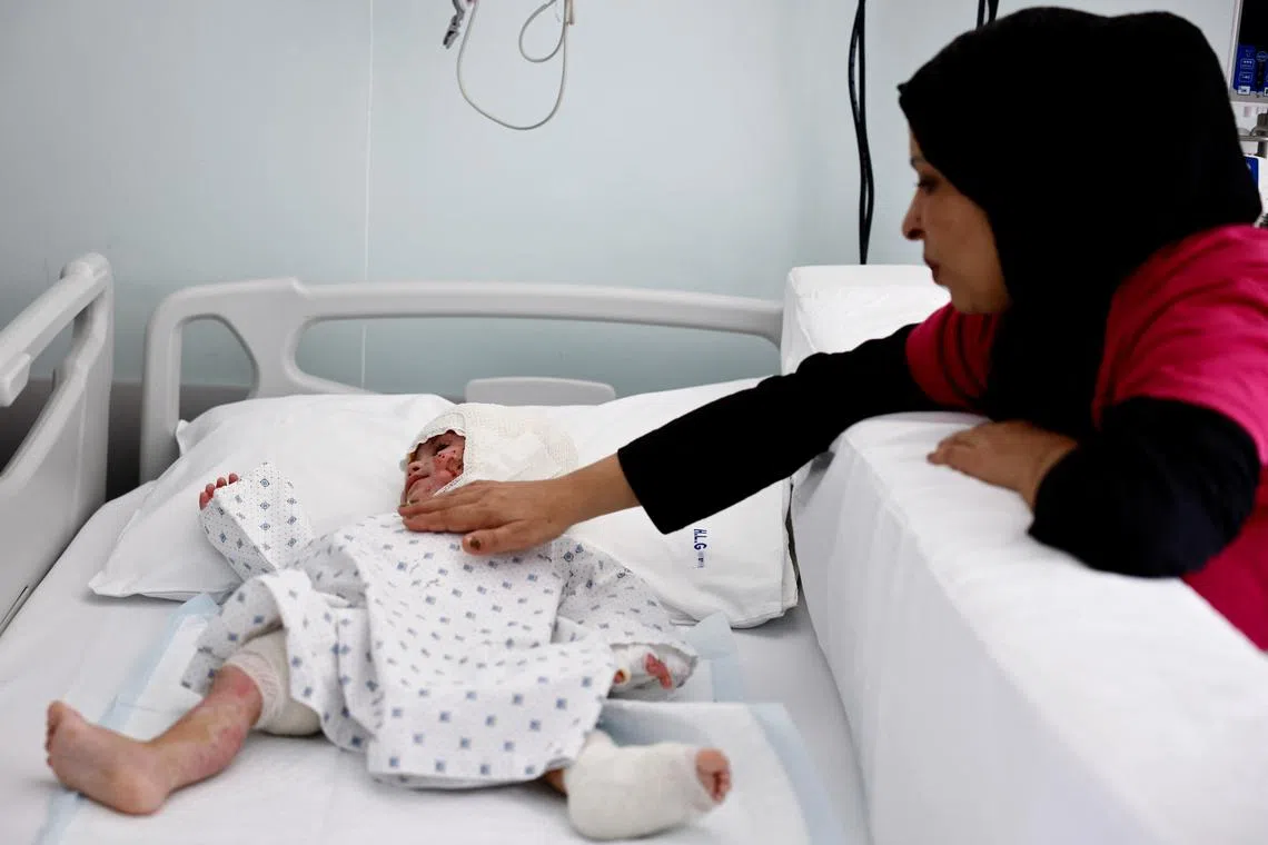 Fatima Zayoun caresses her two-year-old daughter Ivana Skayki, who suffered third-degree burns over nearly half of her body from an Israeli strike in southern Lebanon, lying in bed at Geitaoui Hospital in Beirut, Lebanon October 30, 2024. REUTERS/Yara Nardi