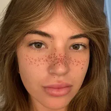 Beauty influencer Sierra Cannon says she felt her face “was meant to have freckles”.
