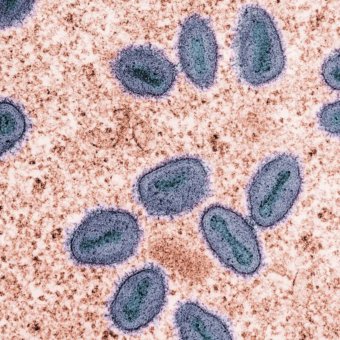 The risk of mpox spreading to the public is currently low as the disease is mainly transmitted through intimate or prolonged physical contact, said the Communicable Diseases Agency.