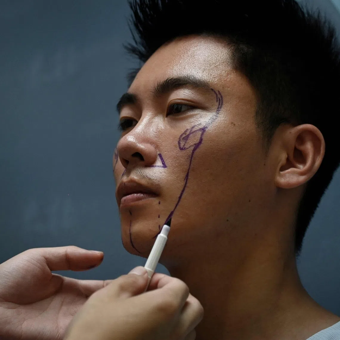 The percentage of foreign patients who underwent plastic surgery rose by 26 per cent, from 90,494 patients in 2019 to 114,074 in 2023.