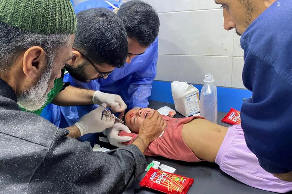 FILE PHOTO: Palestinian girl Orheen Al-Dayah, who was injured in her forehead in an Israeli strike amid the ongoing conflict between Hamas and Israel, has her wounds stitched without anaesthesia, at Al Shifa hospital in Gaza City, November 8, 2023. REUTERS/Doaa Rouqa/File Photo