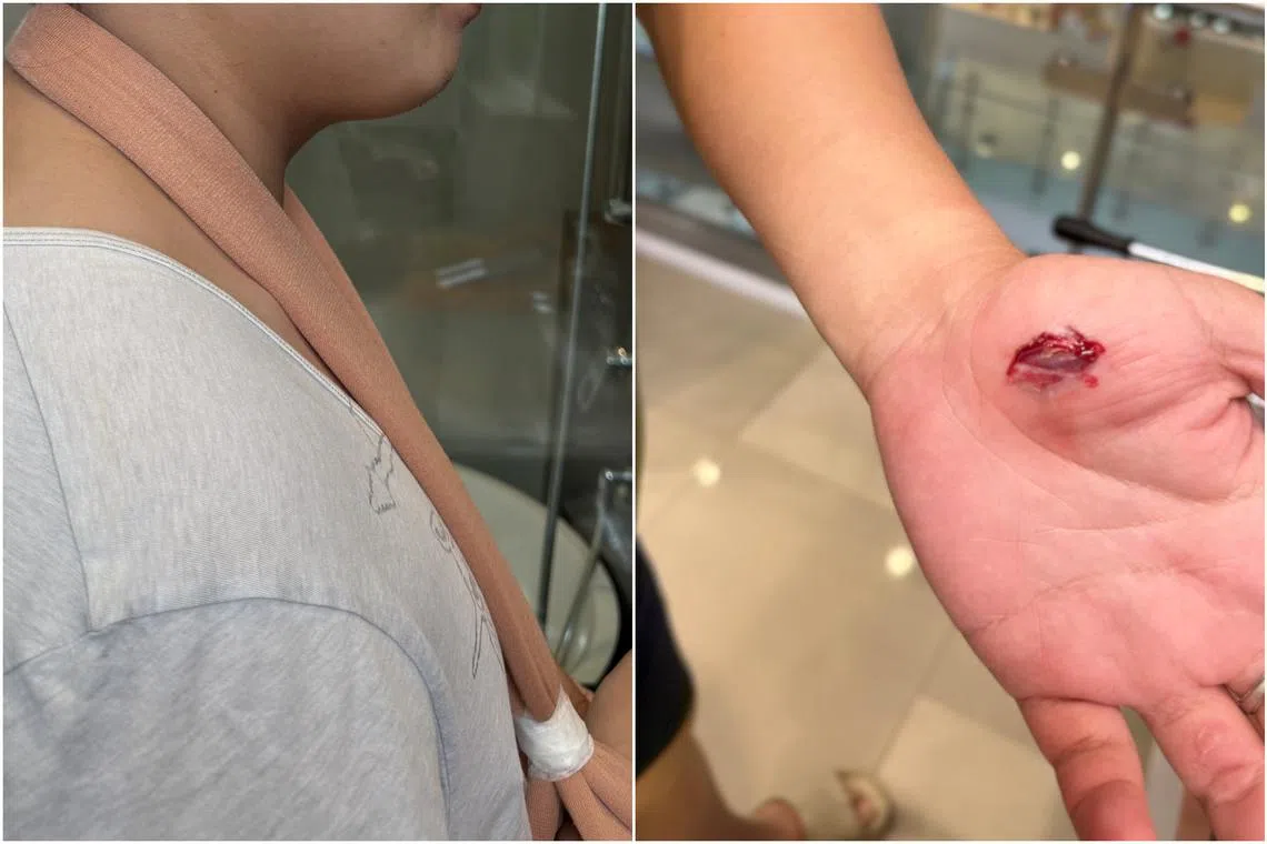 Sam dislocated his right shoulder and suffered two bite wounds after the altercation with the suspect at Kinex Mall on Nov 9. 