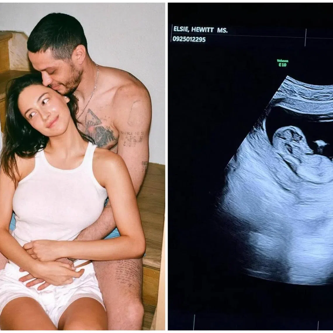 American comedian Pete Davidson and British model Elsie Hewitt announced the pregnancy on July 17.