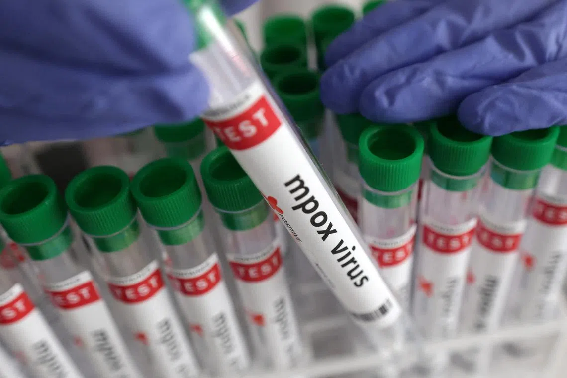 A test tube labelled "Mpox virus positive" is held in this illustration. PHOTO: REUTERS