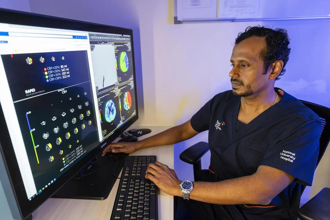 RapidAI processes the imaging data from CT scans to generate easy-to-interpret colour-coded images with information about the brain damage from acute ischemic strokes