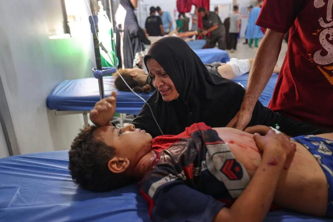 EDITORS NOTE: Graphic content / A Palestinian woman comforts an injured child at the Al-Awda hospital in Nuseirat in the central Gaza Strip, following Israeli strikes on July 13, 2025. Gaza's civil defence agency said Israeli air strikes on July 13 killed at least 29 Palestinians, including six children near a water distribution point. (Photo by Eyad BABA / AFP)