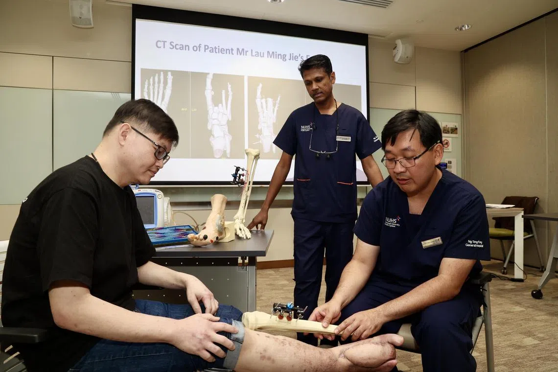 CMG20241212-KwongKC01 /邝启聪/刘安琪/First-known-in-Singapore: reconstruct foot with combi surgery/Adj Asst Prof Vigneswaran N, Head of Division & Senior Consultant, Division of Plastic, Reconstructive & Aesthetic Surgery, NTFGH and Adj A/Prof Chen Yongsheng, Consultant, Division of Orthopaedic Trauma Surgery, NTFGH/ patient Mr Lau Ming Jie