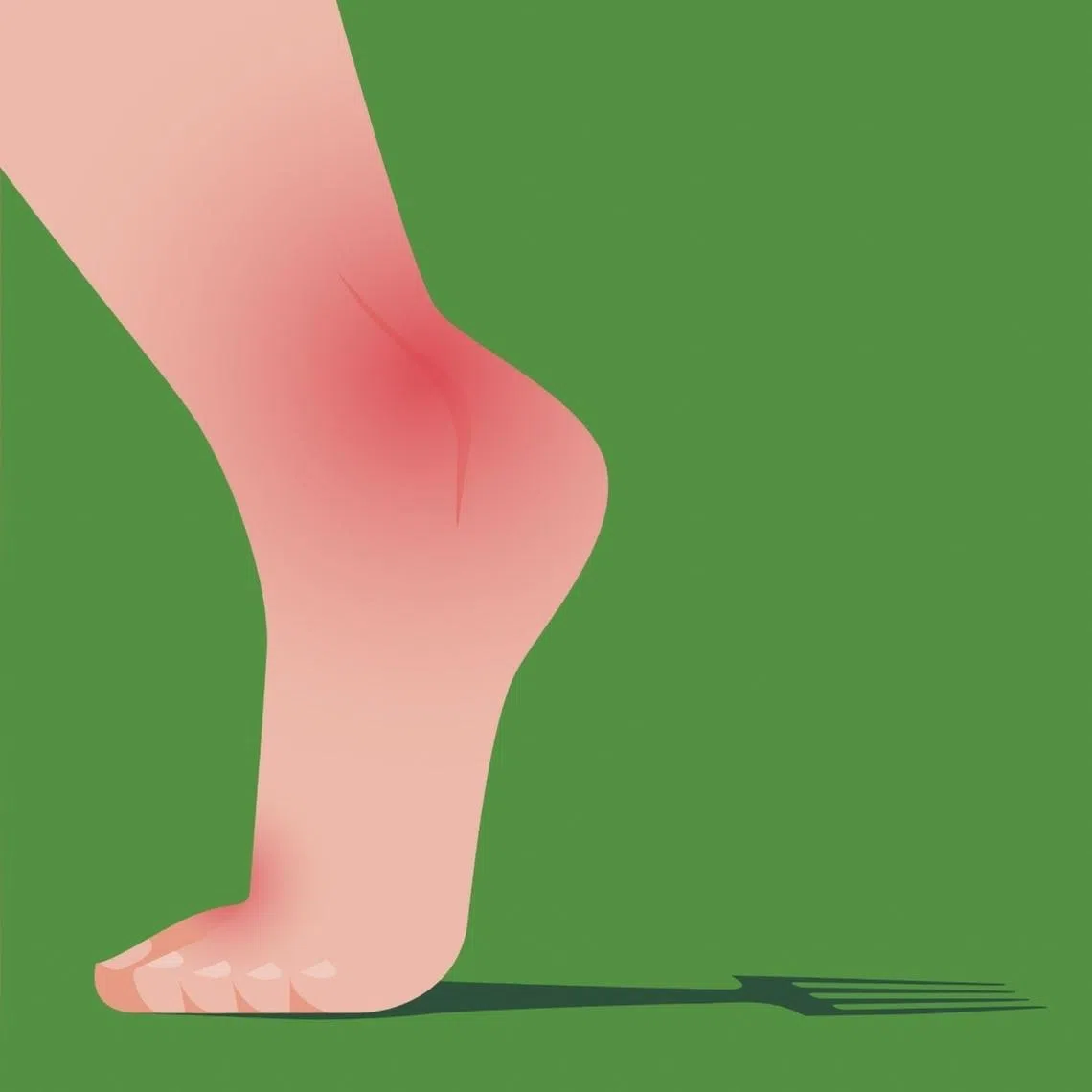 Gout is an increasingly common condition, but stigma often prevents sufferers from obtaining treatment. 