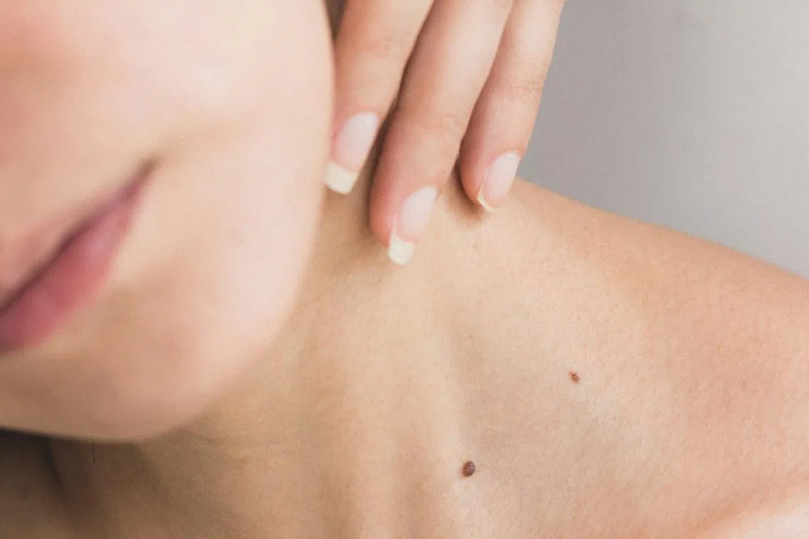 The global incidence of skin cancers has been gradually rising over the years.