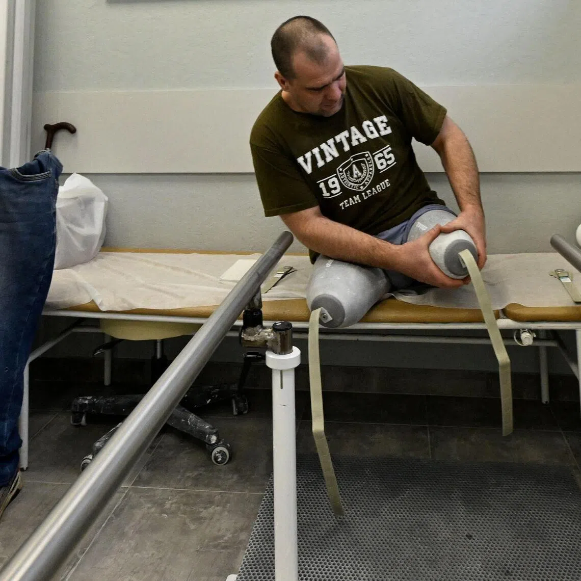 A patient visits the private prosthetics workshop in the Leningrad region on Jan 22.