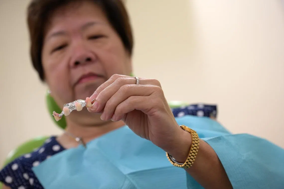 Retired nurse Lim Soon Lian, 65, with her fourth removable partial denture, which she said is the best fitting by far. 

Demand for removable partial dentures (RPDs) is set to rise with Singapore’s ageing population and high prevalence of edentulism (being wholly or partially toothless) among seniors. Conventional RPD fabrication is plagued by inefficiencies, including labour intensiveness and technique sensitivities. The new smart digital workflow will transform the production of RPDs, resulting in better quality dentures and faster treatment time for patients.