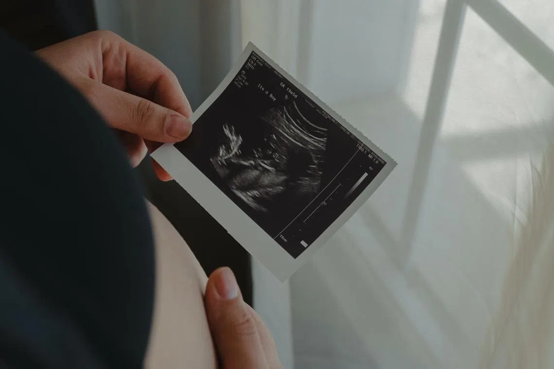 How sick the mother feels depends on a combination of how much of the hormone is produced by the foetus.