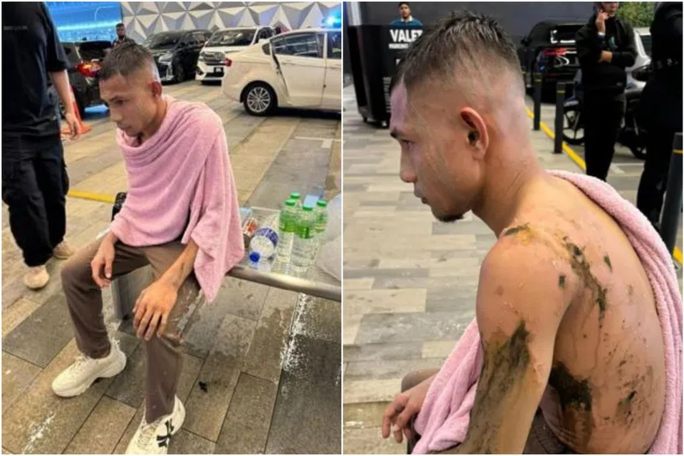 Second suspect nabbed over acid attack on Malaysian national footballer ...