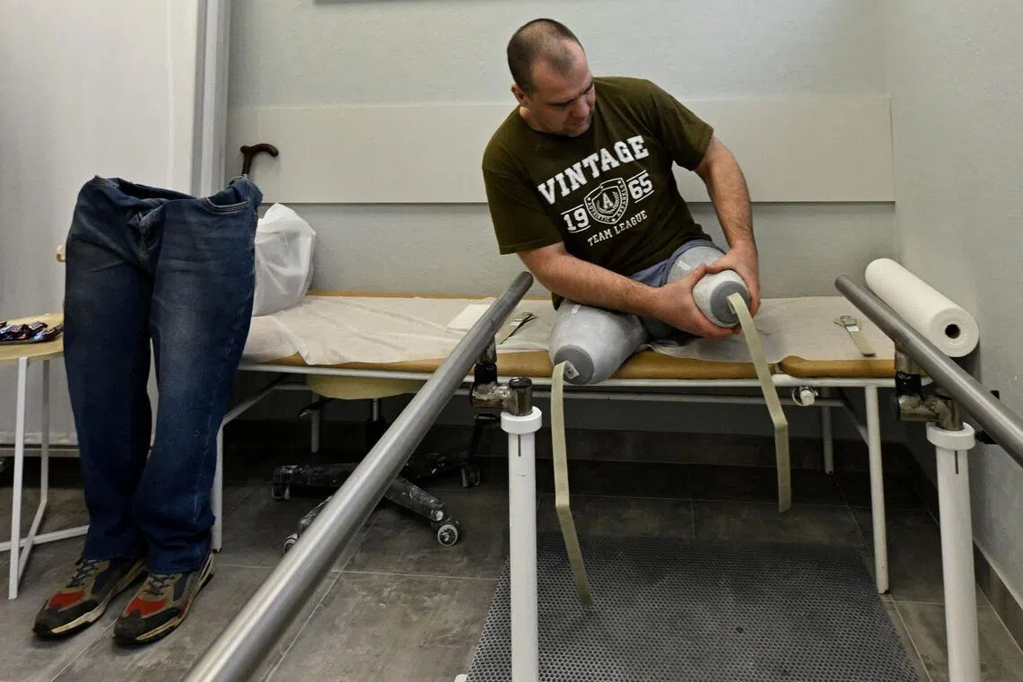 A patient visits the private prosthetics workshop in the Leningrad region on Jan 22.