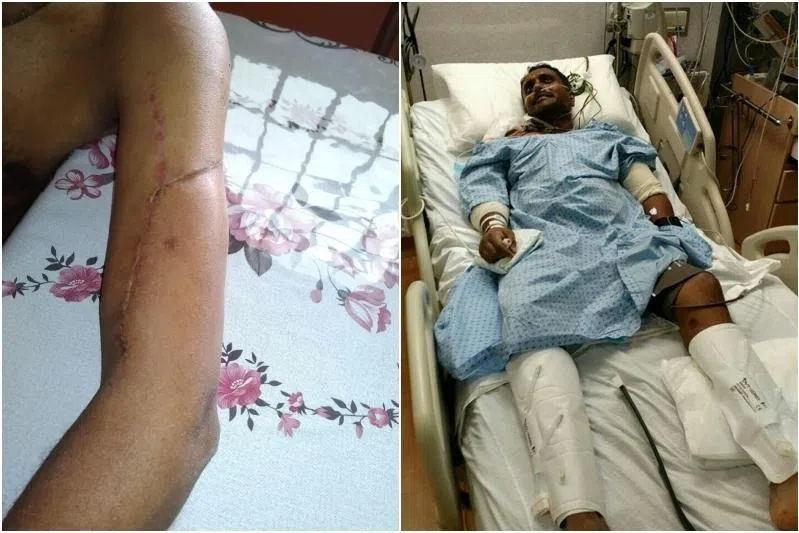 ‘I wondered when it’d be my turn’: Jurong traffic accident victim who heard others flatlining in ICU
