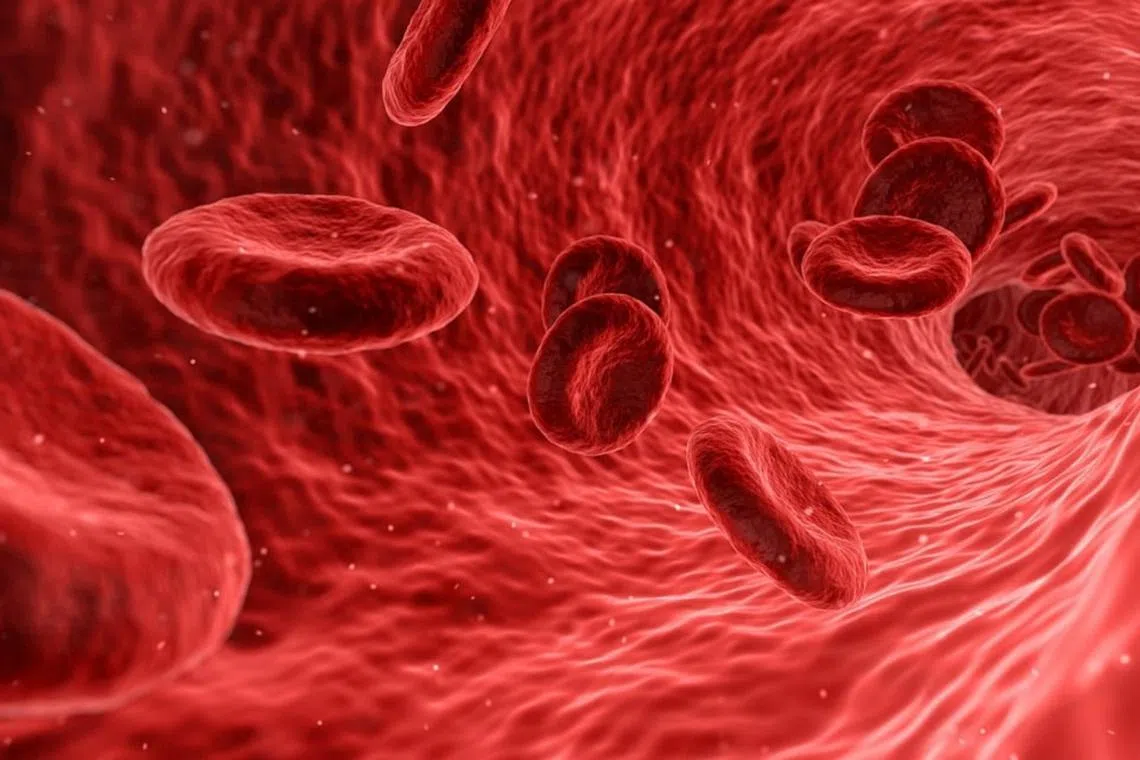 Sickle cell disease and beta thalassemia are genetic conditions caused by errors in the genes for haemoglobin, which is used by red blood cells to carry oxygen around the body.