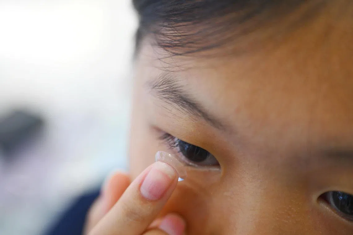 ST20240818_202477000893 vlcontacts Azmi Athni/ Venessa Lee//

**Newsmaker only wants close-ups**

A close-up of Michaela Wang, 13, putting on a contact lens.

ST PHOTO: AZMI ATHNI