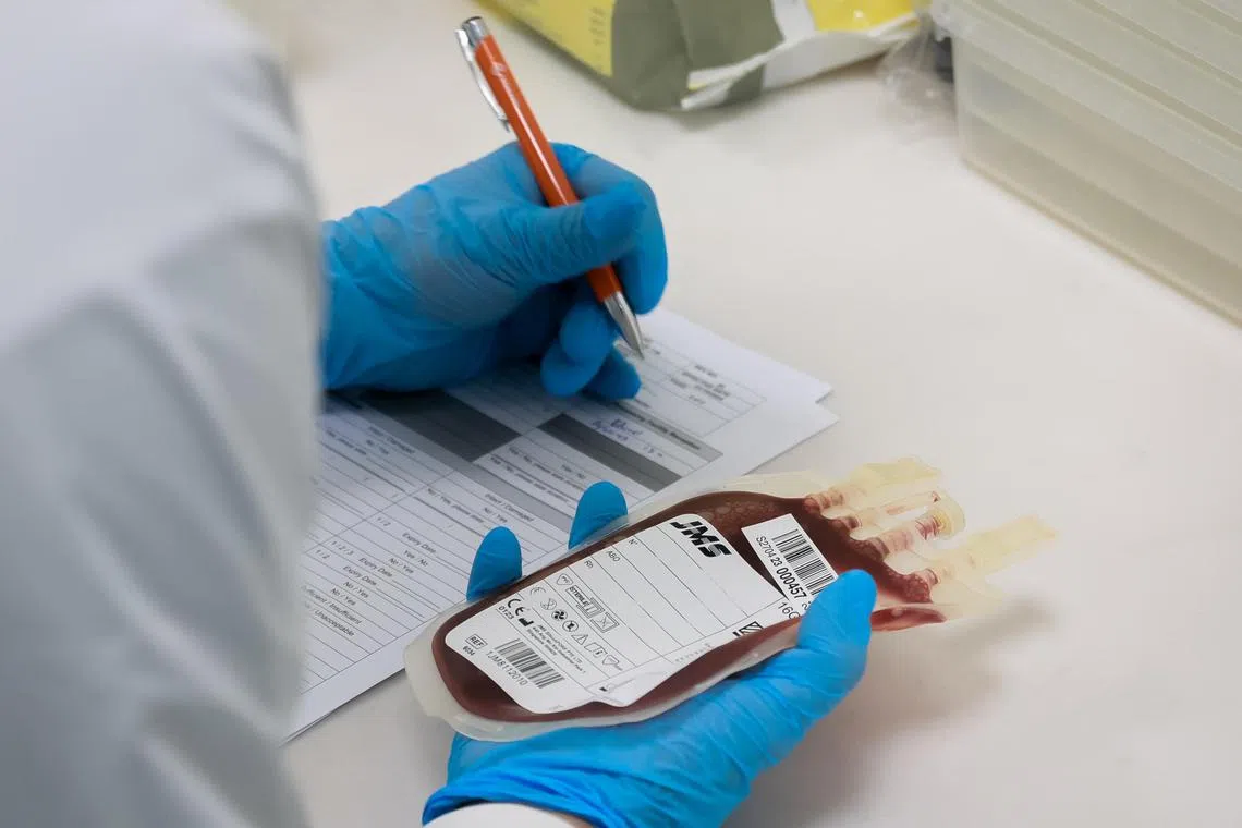 //** NOTE: Photographs of the procedures are for mockup/demonstration purposes only. Prefer to have mockup/demonstration stated in the captions **// 

StemCord Medical Technologist Edward Soo demonstrates receiving a bag of cord blood at their laboratory in Pasir Panjang, Dec 15, 2023.