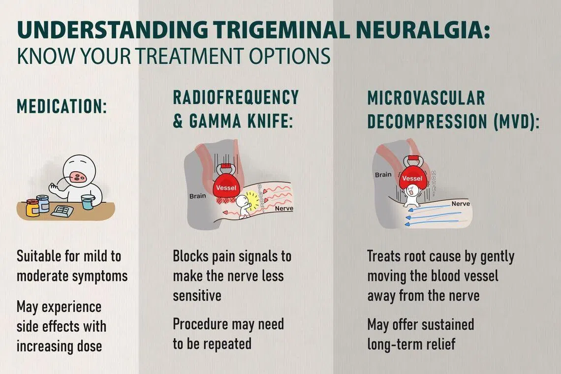 Infographic showing treatment options for trigeminal neuralgia