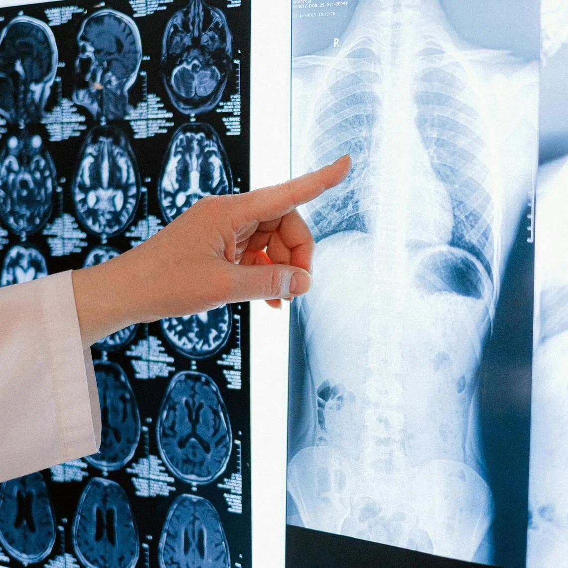 Only 41 per cent of 17 radiologists from 12 hospitals in six countries spontaneously identified AI-generated images.
