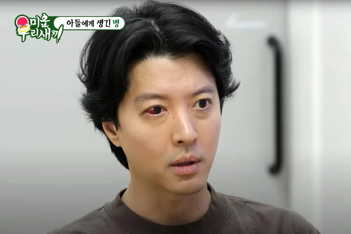 Lee Dong-gun told the doctor that he has had repeated onset of the inflammation of the uveitis on the reality show My Little Old Boy.