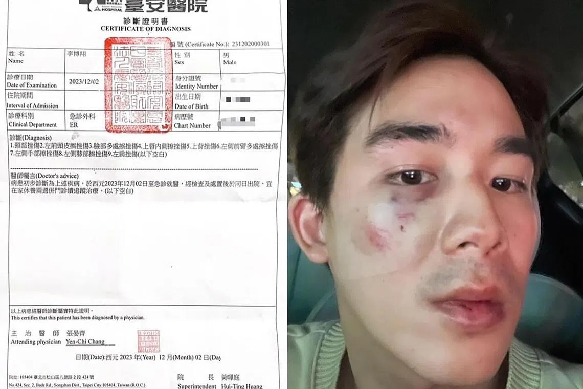 danny04 - Screenshot. Malaysian actor Danny Lee showed the injuries he suffered after he was beaten up by a some men. 



Source / Copyright: LEE_POH_SIANG/INSTAGRAM