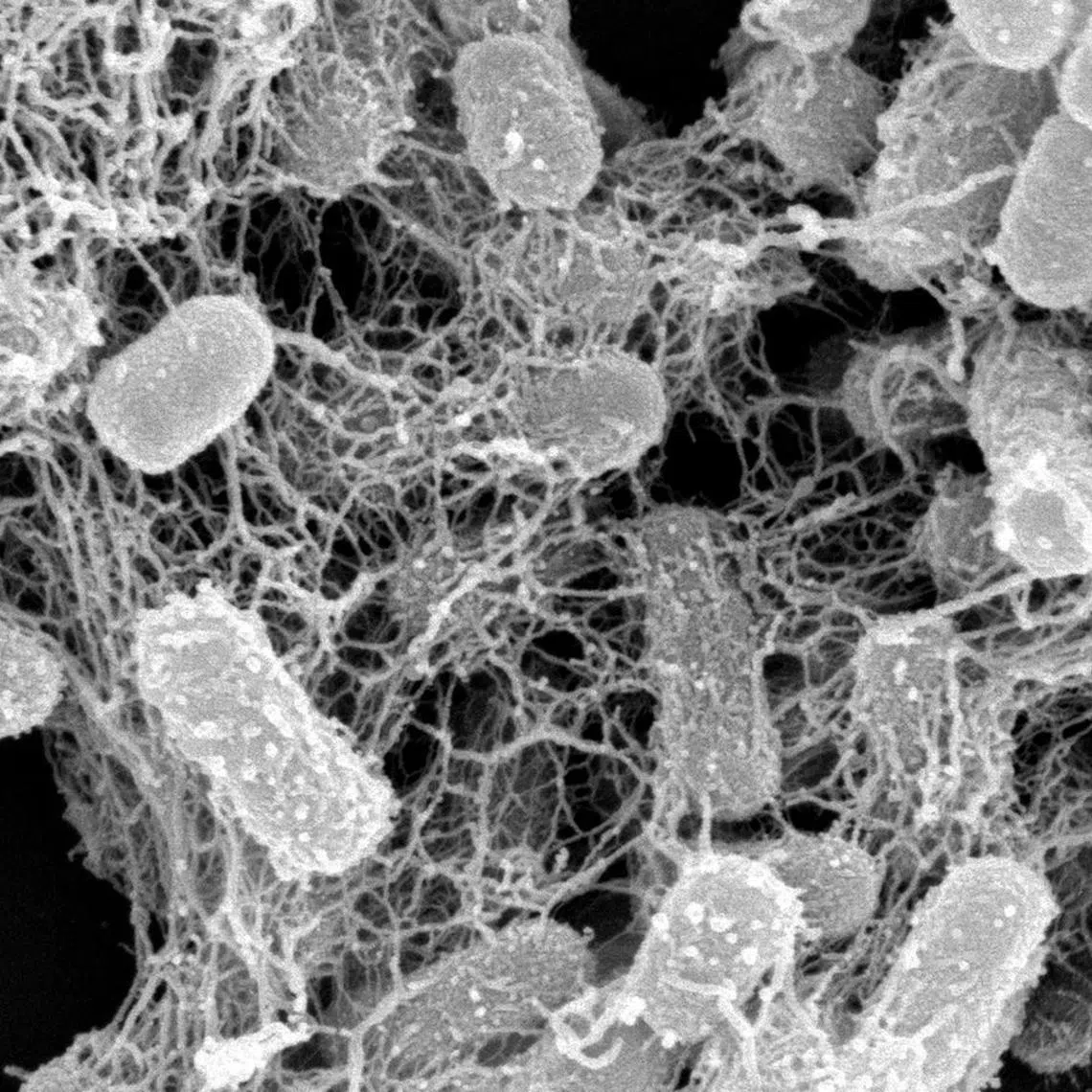 Antibiotic-resistant E. coli entrapped by peptide nanonets. Antimicrobial resistance is projected to kill 10 million by 2050.