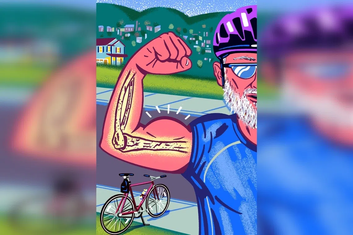 More men are now living long enough to develop osteoporosis. 
