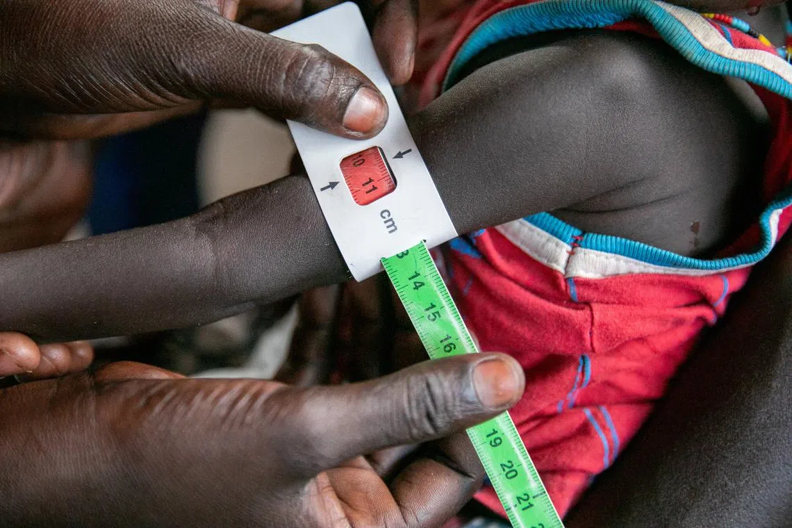 Ms Regina Williams is screened for malnutrition at the Nyong Primary Health Care Unit (PHCU) nutrition site in Torit, within Eastern Equatorial State of South Sudan, in this photo released on Thursday. The World Food Programme (WFP) is implementing blanket supplementary feeding programme (BSFP) nutrition activities for children, pregnant and lactating women in Torit. 