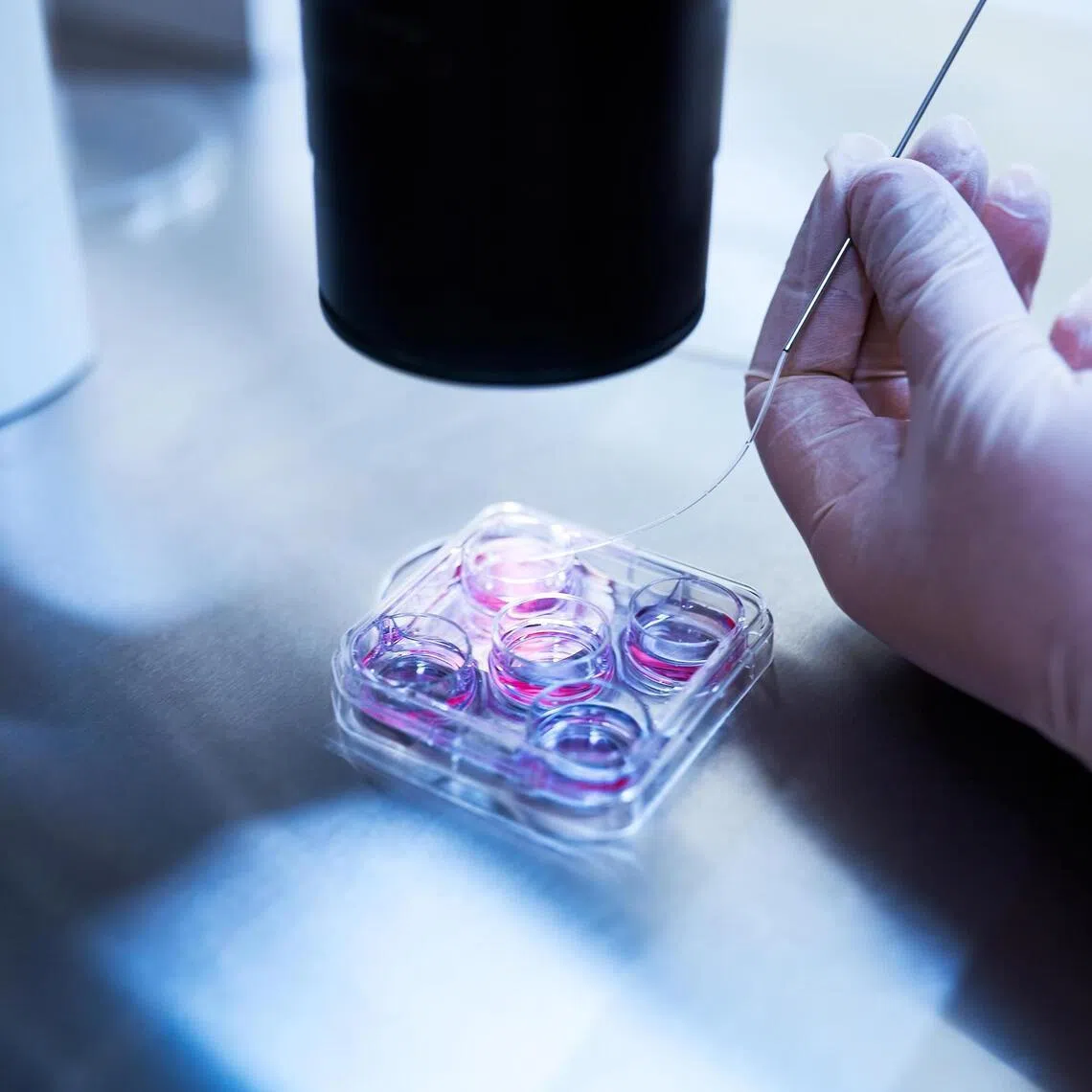 Japan’s public insurance system covers embryo transfers up to six times for women who were under 40 when they began fertility treatment and up to three times for those aged 40 to 42.
