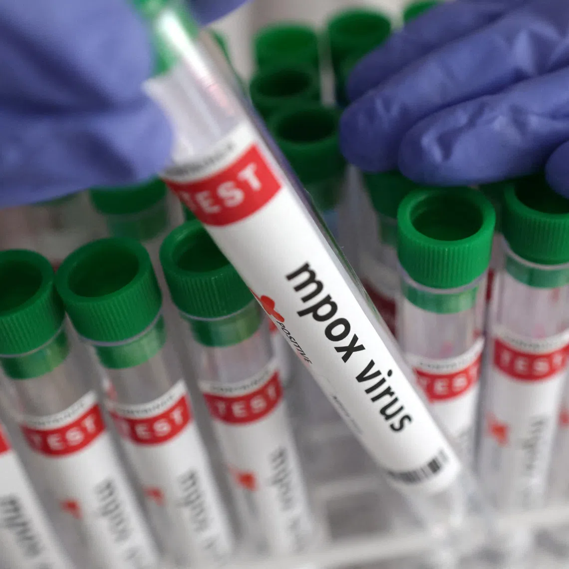 A test tube labelled \"Mpox virus positive\" is held in this illustration taken August 20, 2024. REUTERS/Dado Ruvic/Illustration