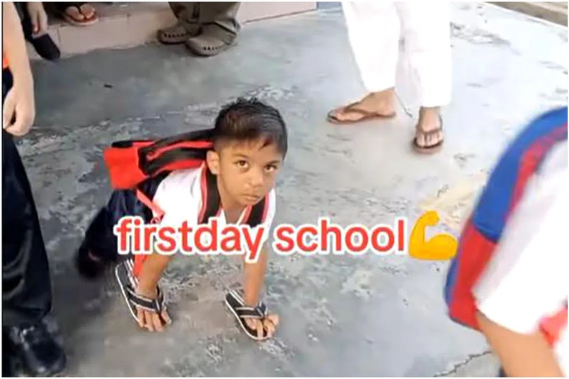 Five-year-old Muhammad Shairid Hadif Ridhuan Shah was diagnosed with a condition that caused him to be born without knees and calves. 