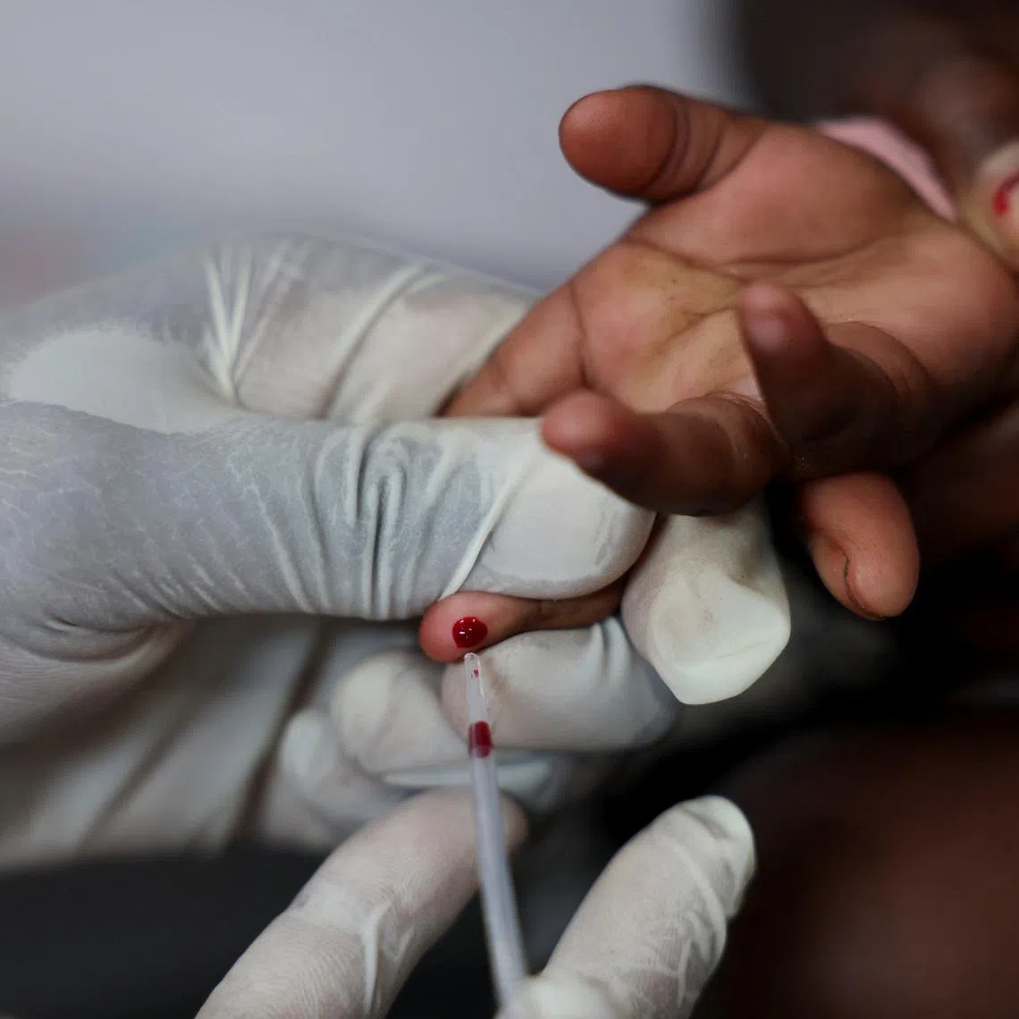 The number of people being tested for HIV dropped sharply in 2025, according to data published by the US State Department last week.