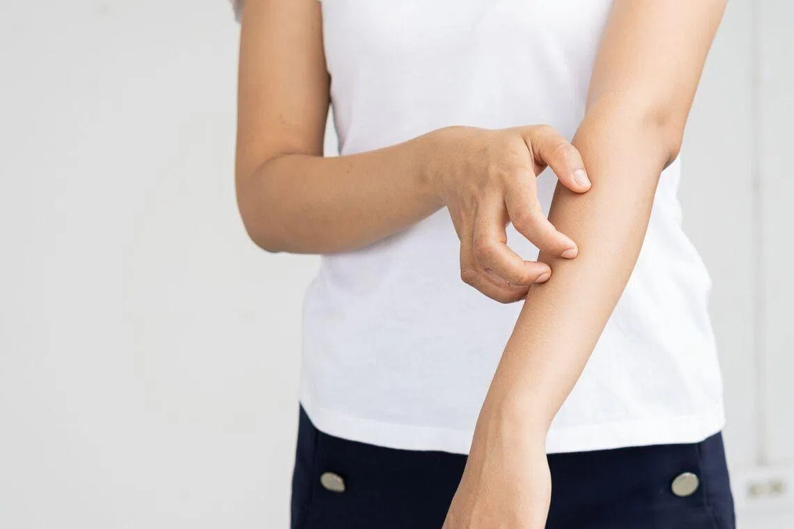 Chronic hives vs allergies: When that persistent itch signals a bigger problem