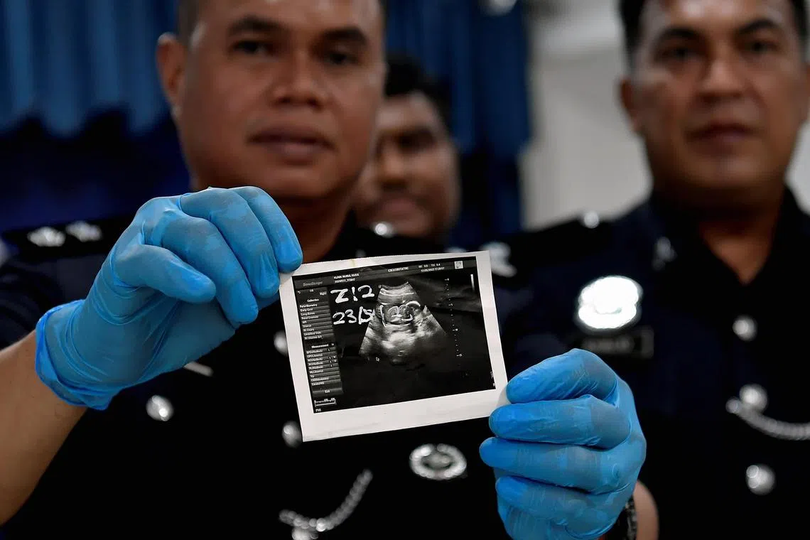Sabak Bernam Police Chief Superintendent Agus Salim Mohd Alias showing a photo of the ultrasound scan of the victim.