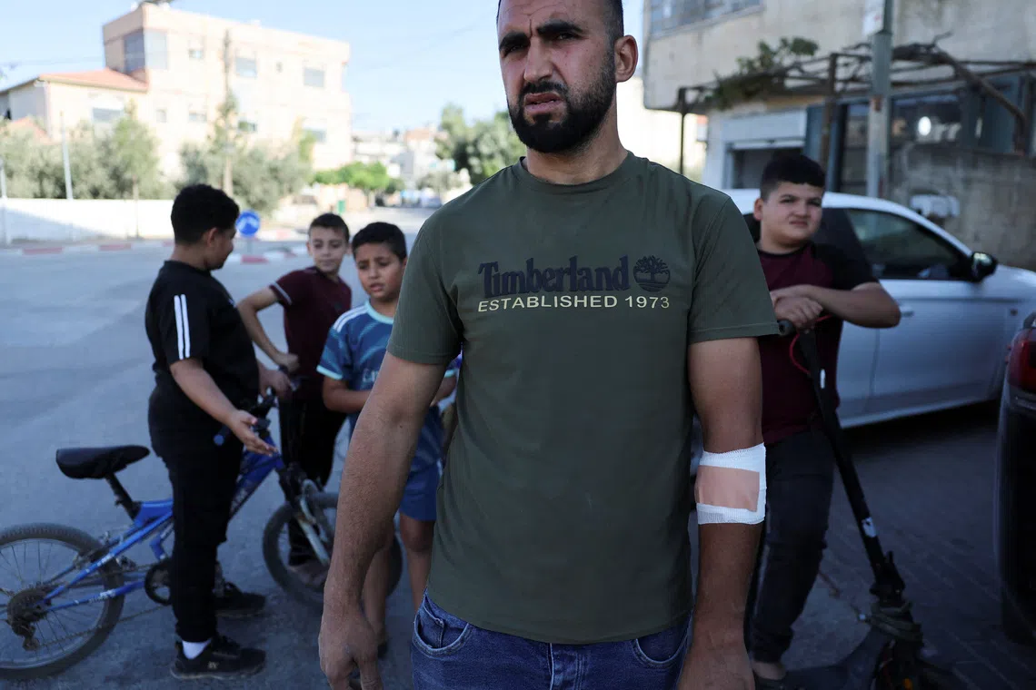 Luay Bayrudi, the owner of a house that came under settler attack, outside of the medical center in Qusra, in the Israeli-occupied West Bank, August 29, 2026. REUTERS/Ammar Awad
