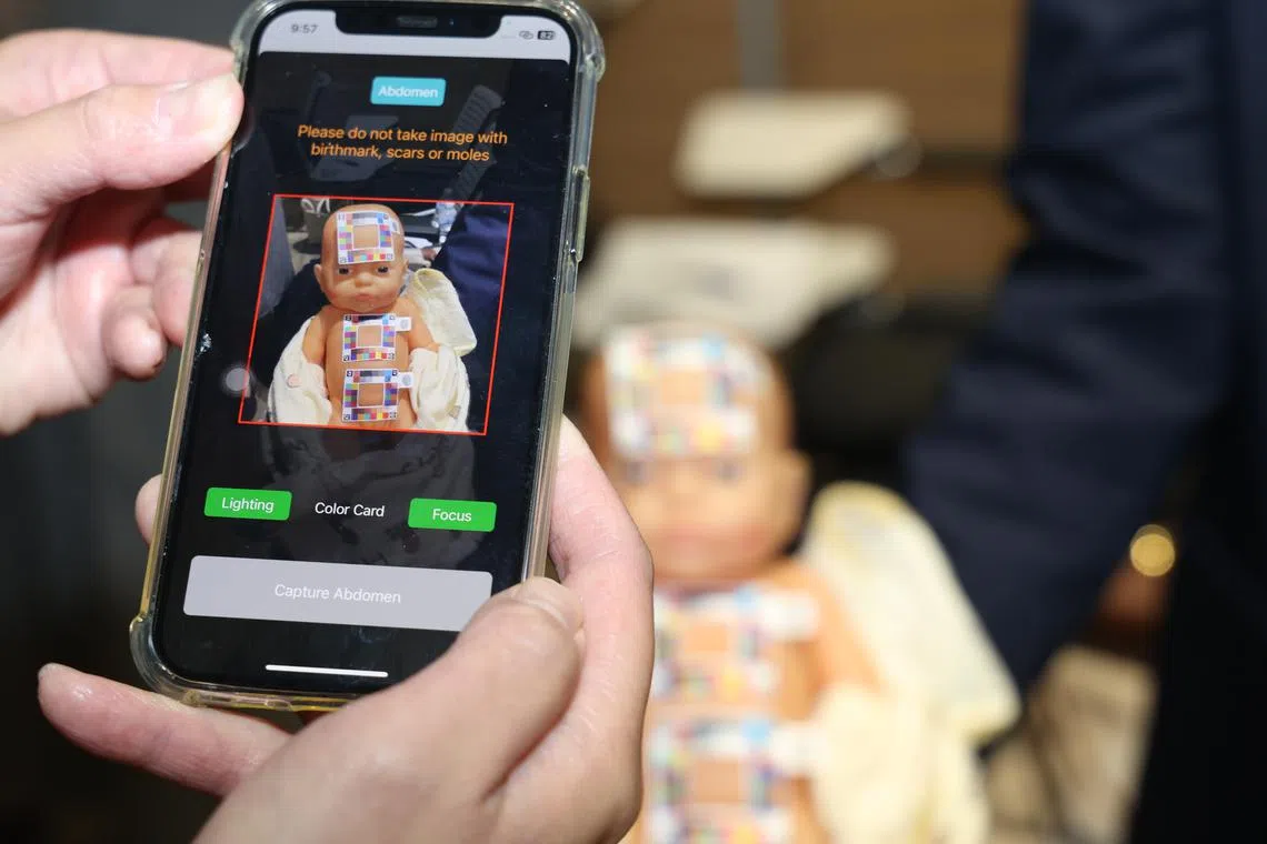 New app allows parents to test baby for jaundice from home