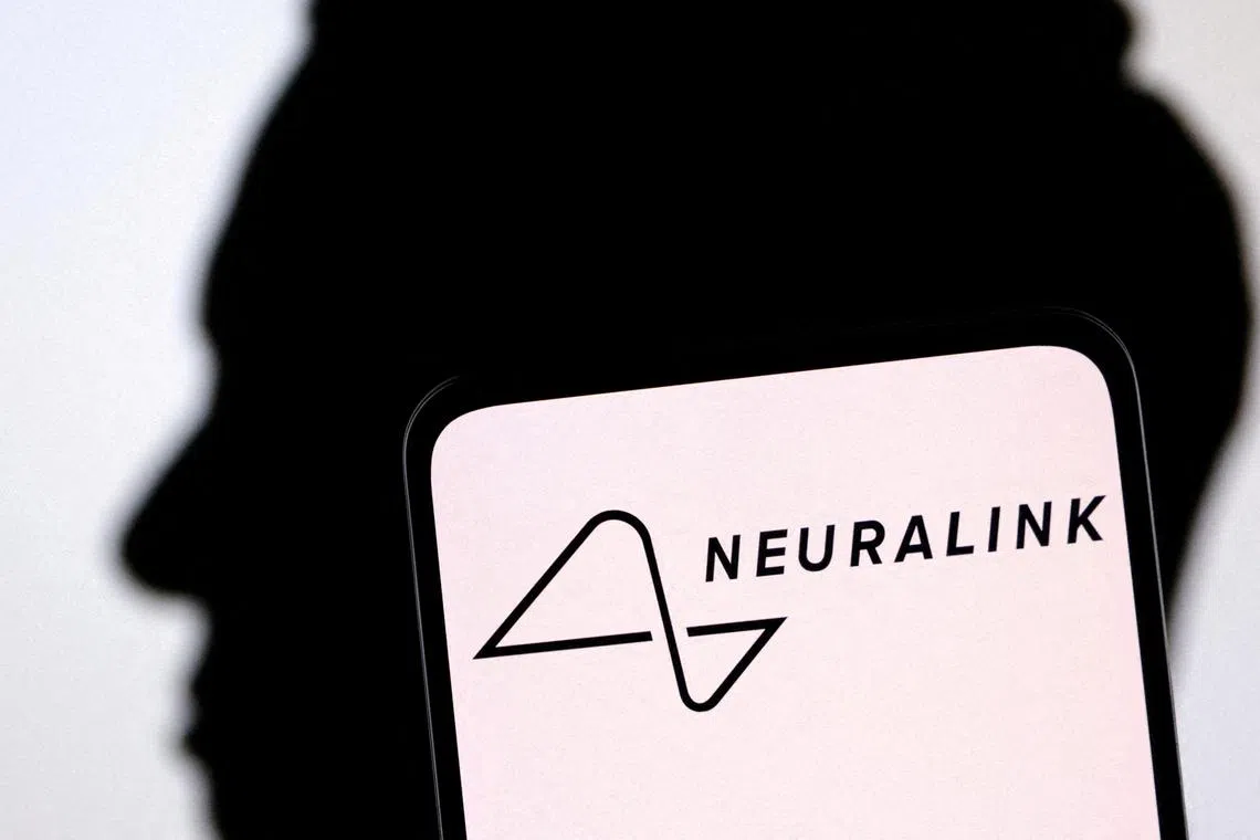 Elon Musk’s neurotechnology company installed a brain implant in its first human patient in January.