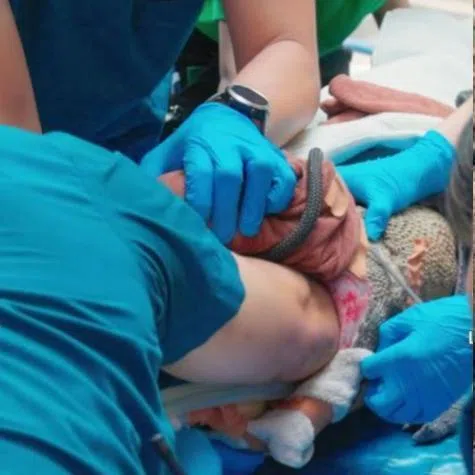 The team had little choice but for Dr Heng to inserted his hand into Mario’s stomach.