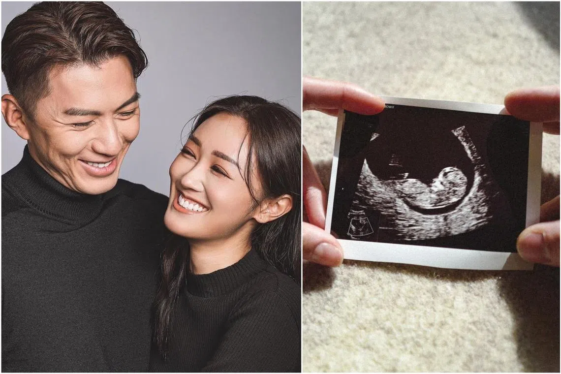 The couple broke the news on their individual Instagram accounts on Thursday, sharing a photo of an ultrasound scan.