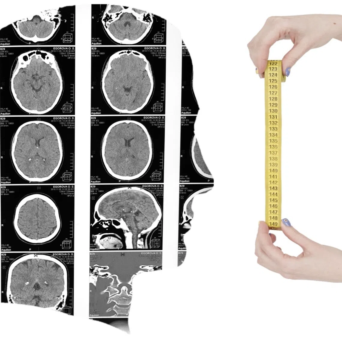 Our brains are not fixed and remain malleable over the course of our lives, reorganising as we mature and engage in new experiences.